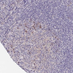 LTK Antibody, Novus Biologicals 25 &mu;L, Unlabeled:Antibodies, Polyclonal